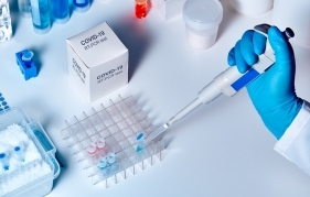 135 заразни при направени 5 252 PCR теста